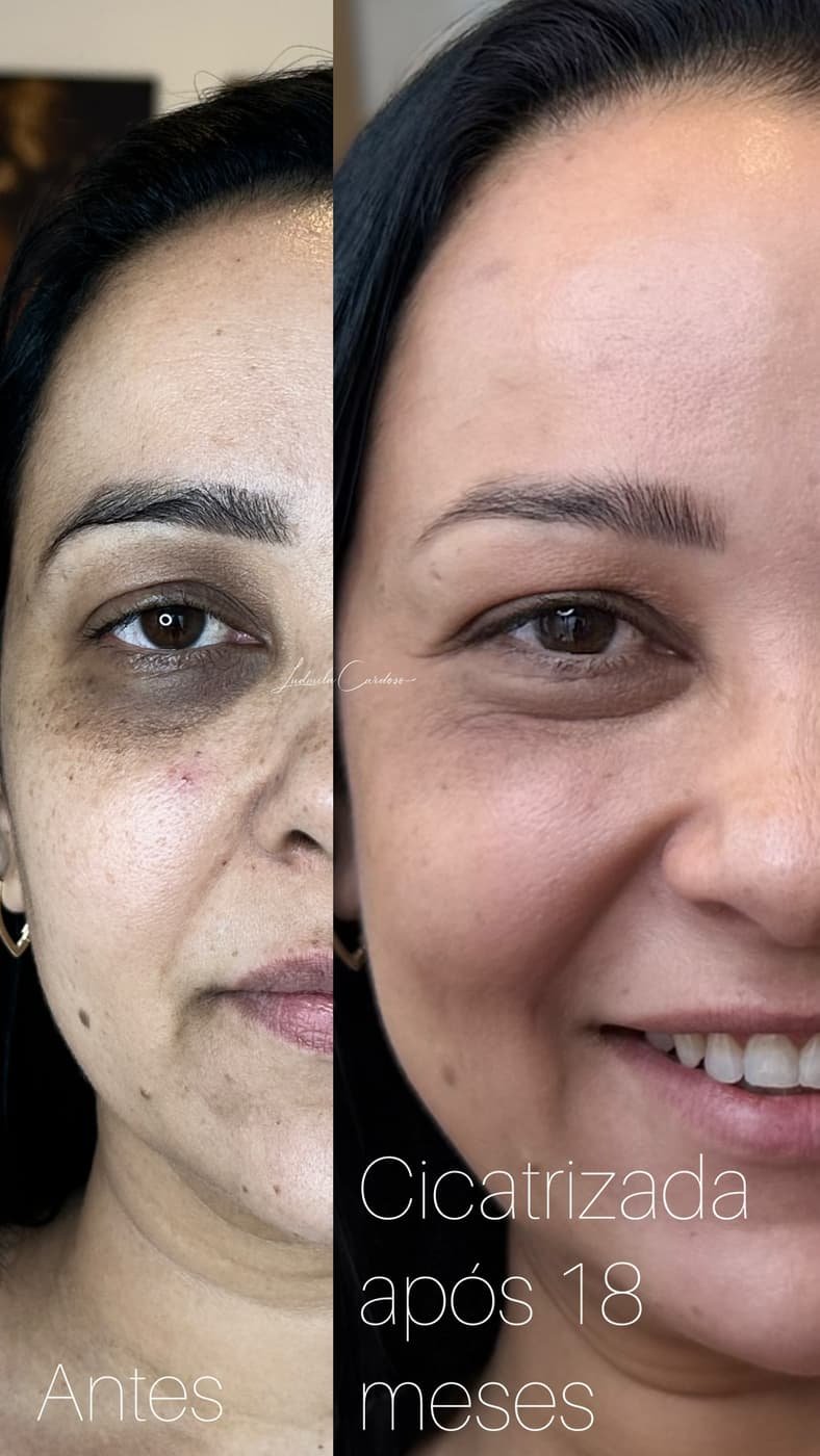Resultado 21