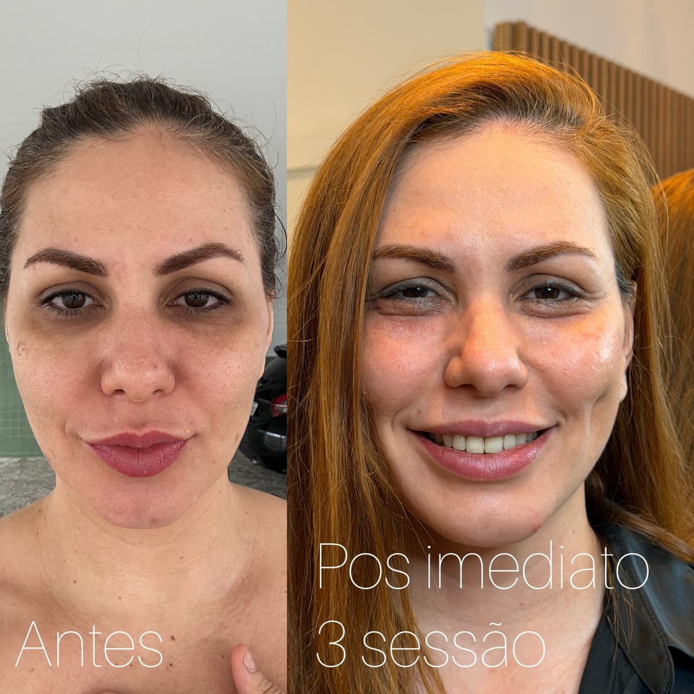 Resultado 24